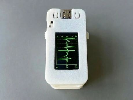 AI-Enabled Multi-Parameter Health Monitoring Wearable